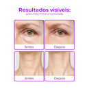 RejuMax - Combo Rejuvenescedor Para Pescoço e Olhos Que Firma e Suaviza Linhas Devolvendo Juventude à Pele