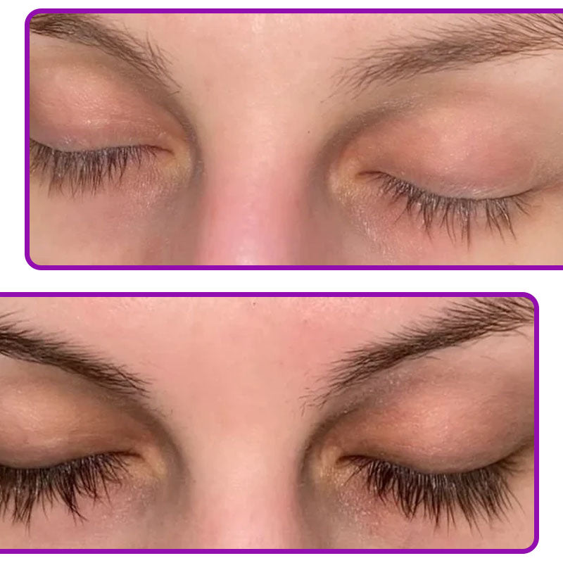 Lanffy - Sérum De Crescimento Que Ativa os Bulbos Capilares Dos Cílios