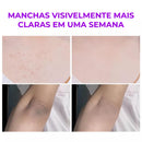 Melashot – Spray Esfoliante Corporal Que Clareia Manchas e Deixa a Pele Lisa e Iluminada em Minutos